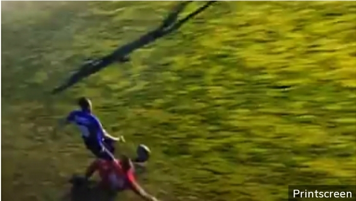 UZNEMIRUJUĆA SCENA Igraču u Surdulici slomljena noga, svi se hvatali za glavu (VIDEO)