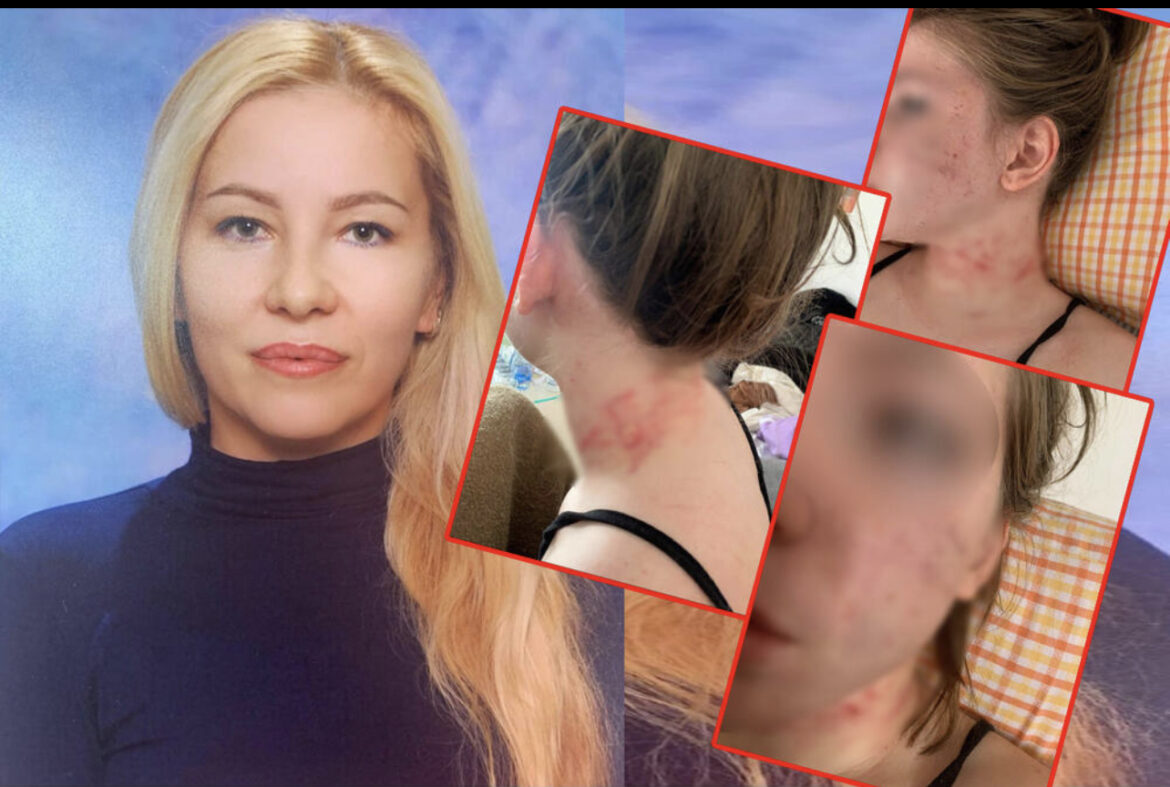 ĆERKA MI SE 15 MINUTA BORILA ZA ŽIVOT: Majka Uki Q o drami koju je porodica prošla pošto je njena druga ćerka pretučena! 