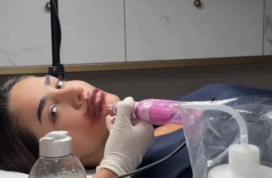 Anđela zgrozila javnost, šta joj se desilo sa licem? Ovjavila video, pa je urnisali u komentarima