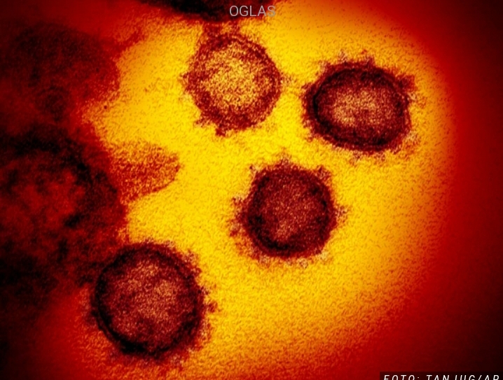 UBIJA SKORO SVAKOG DRUGOG ZARAŽENOG Pojavio se novi virus u Velikoj Britaniji, dva putnika već izolovana