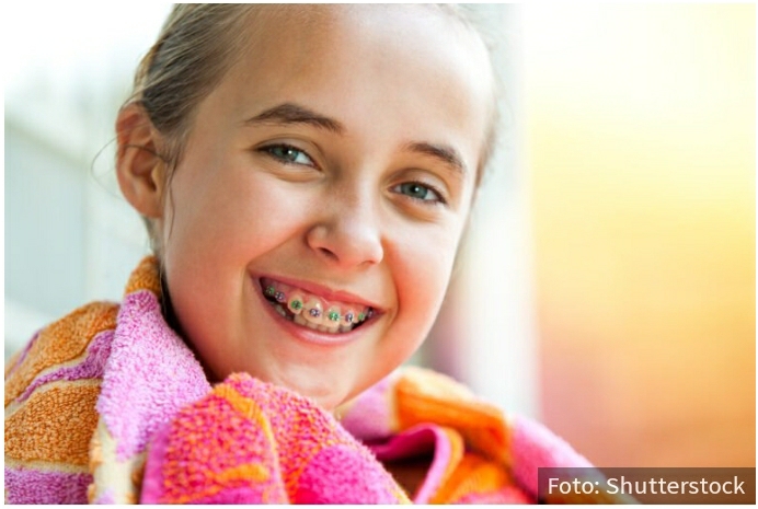 Nepravilni zubi mogu da izazovu brojne probleme: Kada je pravo vreme da vaše dete stavi PROTEZU?