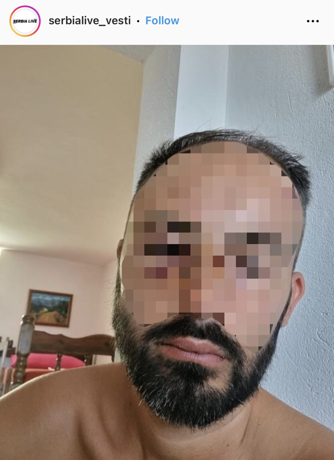 „NOS MI JE POLOMLJEN, IMAM HEMATOME PO GLAVI“ Oglasio se Srbin koji je pretučen u Sutomoru: Pokušao sam da ih zaobiđem, a onda sam osetio snažan udarac sa leđa (FOTO) 