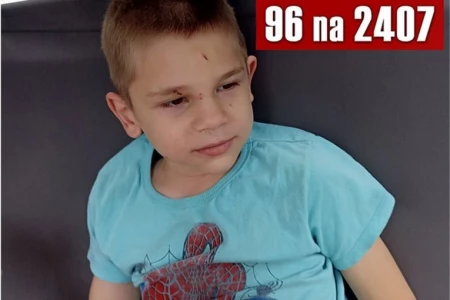SRBIJO, KOSTI SMO POTREBNI! Boluje od retke bolesti, a jedina nada su mu terapije matičnim ćelijama u Turskoj! 